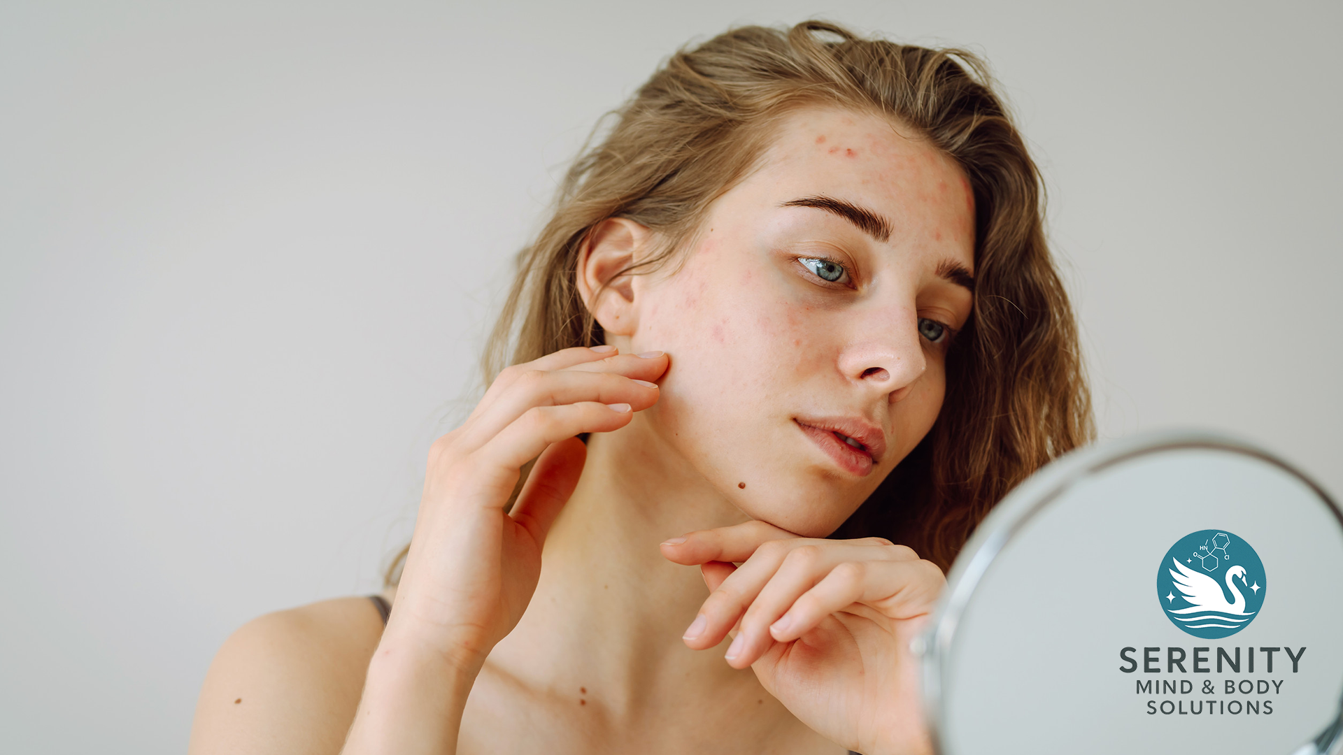 Acne and oil control facial treatment Lakeland Florida